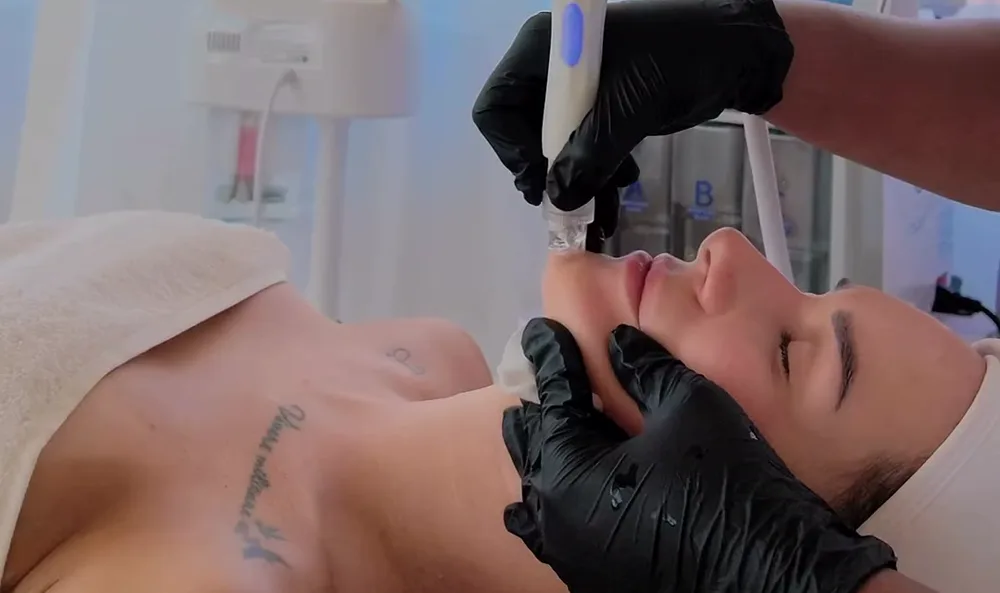 Aquafacial (Hydra Glow Facial) bei Lune Beauty in Worms